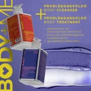 aox-problem