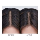 Moroccanoil Oily Scalp Treatment kezelőolaj zsíros fejbőrre3