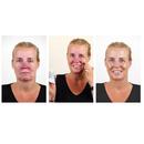 Kép 5/6 - Rosalique 3 in 1 Anti-Redness Miracle Formula CC-krém rosaceás és érzékeny bőrre SPF505