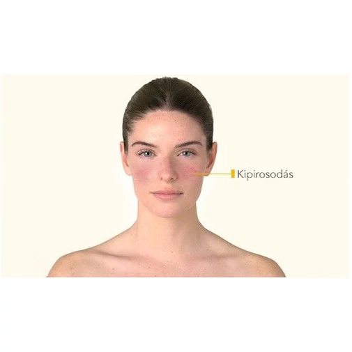 Bioderma Photoderm AR+  színezett fényvédő rosaceás bőrre SPF50