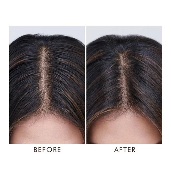 Moroccanoil Oily Scalp Treatment kezelőolaj zsíros fejbőrre3
