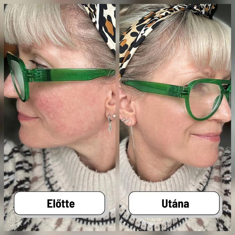 Altruist Dermatologist Anti-Redness & Pigmentation LIGHT színezett fényvédő érzékeny bőrre SPF50