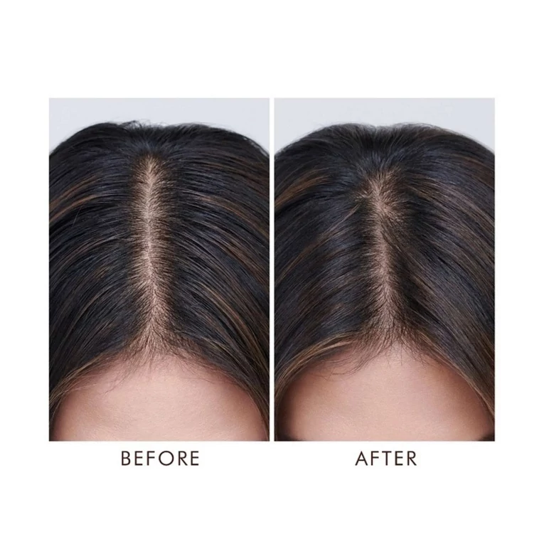 Moroccanoil Oily Scalp Treatment kezelőolaj zsíros fejbőrre3