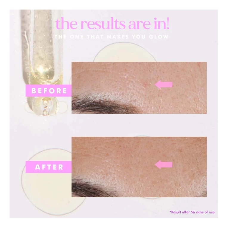 Hello Sunday The One That Makes You Glow pigmentfoltok elleni treatment SPF403