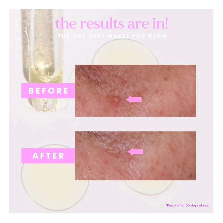 Hello Sunday The One That Makes You Glow pigmentfoltok elleni treatment SPF404