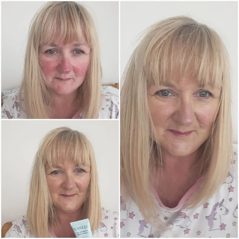 Rosalique 3 in 1 Anti-Redness Miracle Formula CC-krém rosaceás és érzékeny bőrre SPF504
